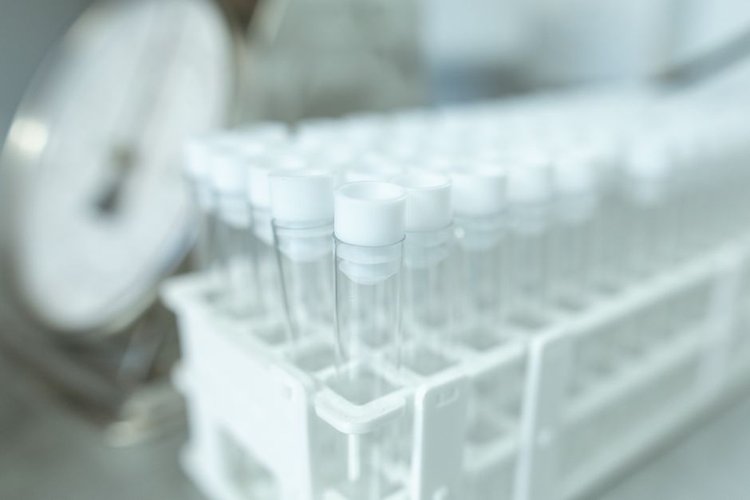 Surplus Chemicals Buyers Across UK — Based Near Coventry, UK